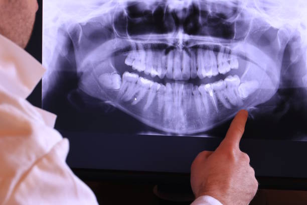 Best Cracked Tooth Emergency Dentist  in Port Barre, LA