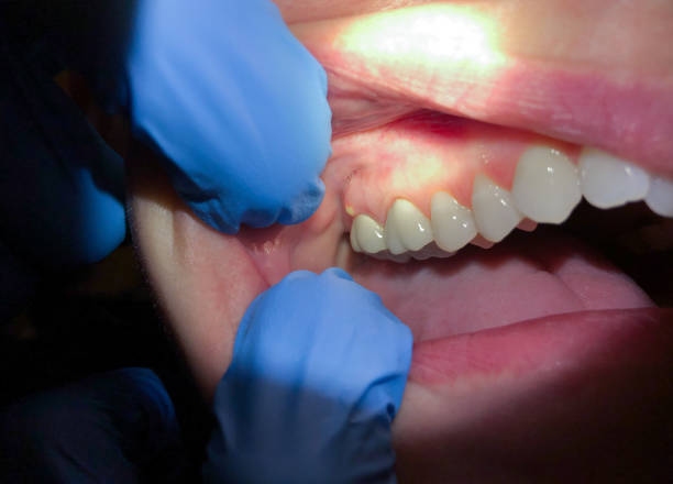 Best Emergency Gum Pain Relief  in Port Barre, LA