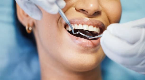 Best Tooth Infection Emergency Dentist  in Port Barre, LA