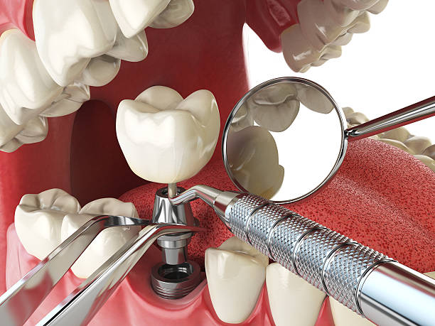 Best Tooth Pain Emergency Relief  in Port Barre, LA